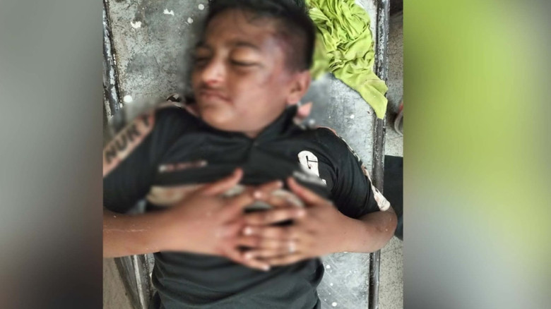 যশোরে ভবনের তৃতীয় তলা থেকে পড়ে কিশোর সহ দুই নির্মাণ শ্রমিক আহত